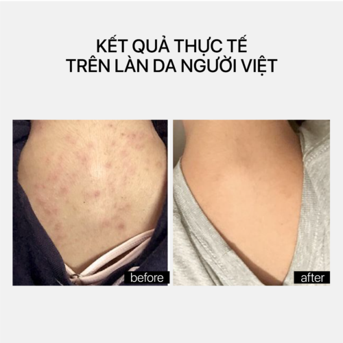 Alternative view of TRANSPARENT LAB AHA SMOOTHING BODY LOTION